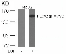 PLCg2(Phospho-Tyr753) Antibody