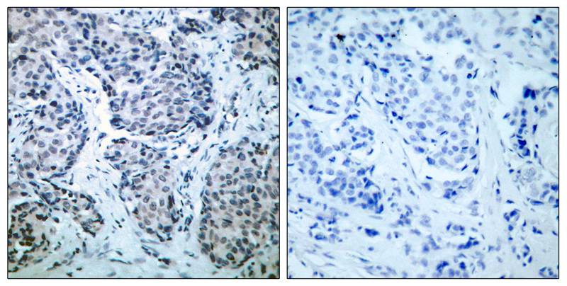 SEK1/MKK4(Phospho-Thr261) Antibody