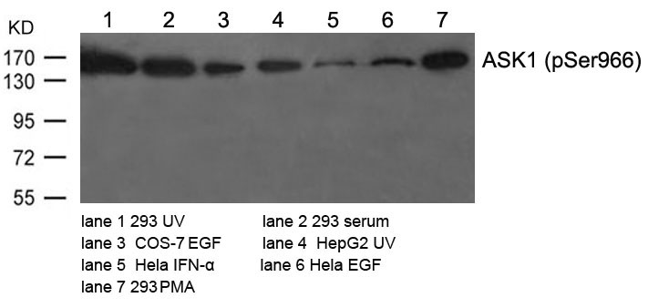 ASK1(Phospho-Ser966) Antibody