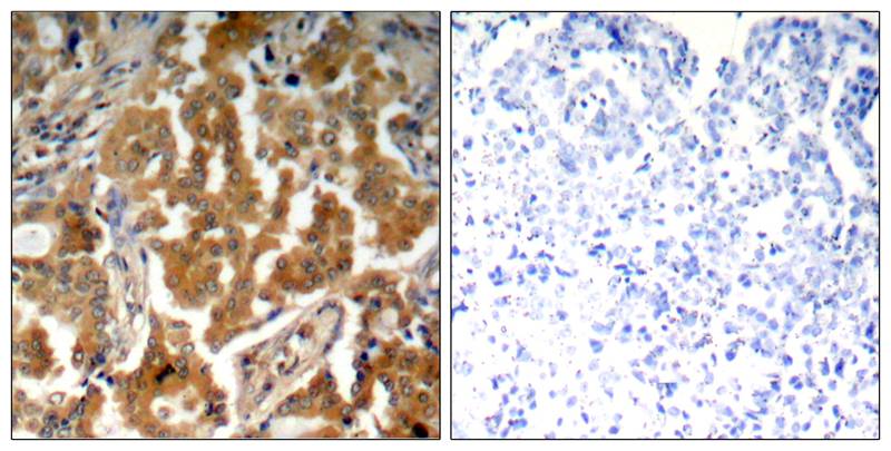 ADD1(Phospho-Ser726) Antibody