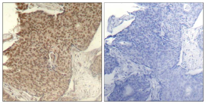 HDAC2(Phospho-Ser394) Antibody