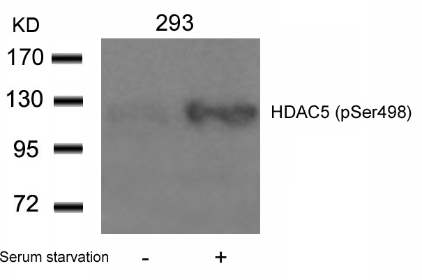 HDAC5(Phospho-Ser498) Antibody