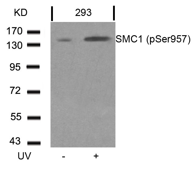 SMC1(Phospho-Ser957) Antibody