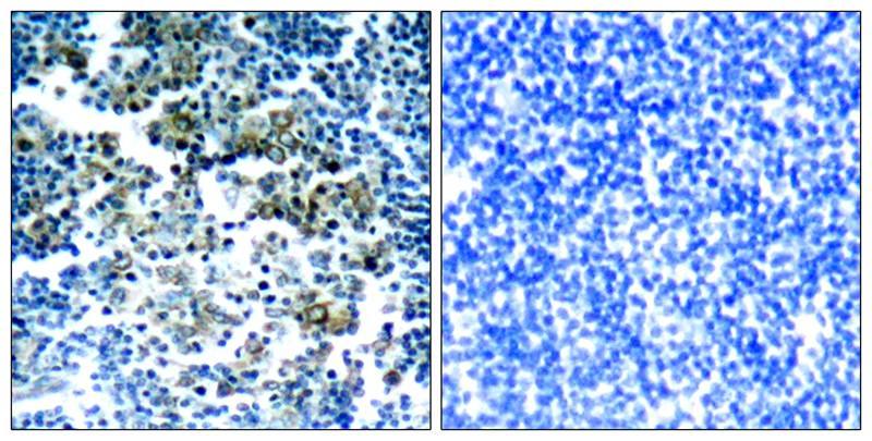 Bcr(Phospho-Tyr177) Antibody