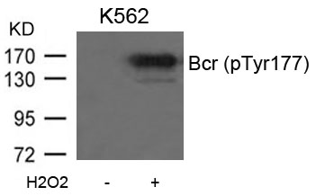 Bcr(Phospho-Tyr177) Antibody