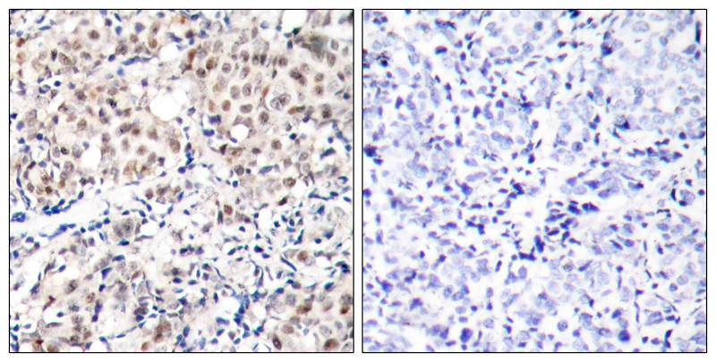 p27Kip1(Phospho-Thr187) Antibody