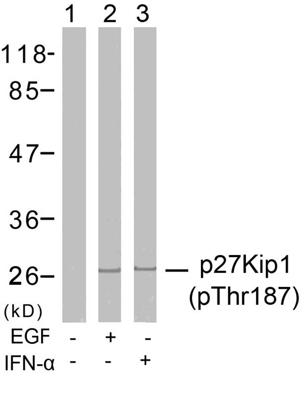 p27Kip1(Phospho-Thr187) Antibody