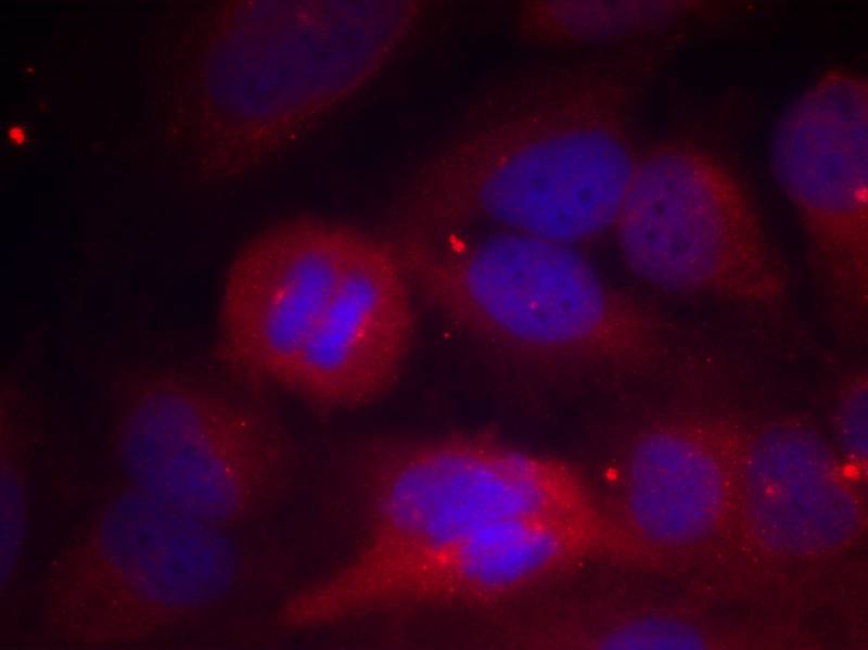 Tyrosine Hydroxylase(Phospho-Ser40) Antibody