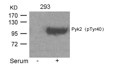 Pyk2(Phospho-Tyr402) Antibody