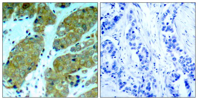 mTOR(Phospho-Ser2448) Antibody