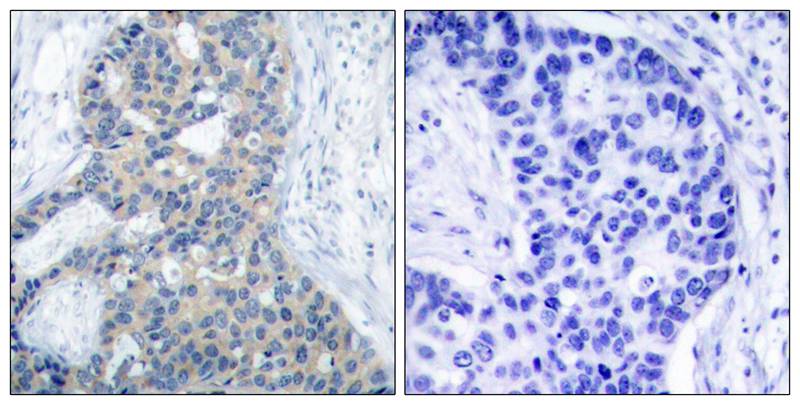 Stathmin1(Phospho-Ser38) Antibody