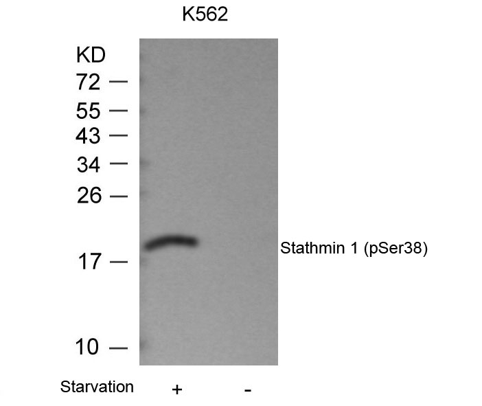 Stathmin1(Phospho-Ser38) Antibody