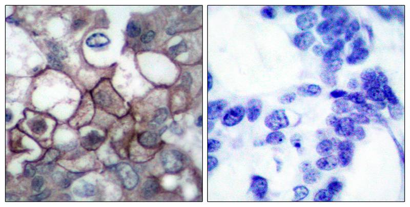 EGFR(Phospho-Tyr1197) Antibody