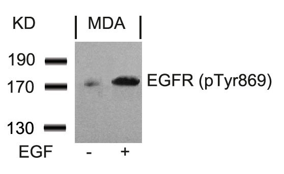 EGFR(Phospho-Tyr869) Antibody