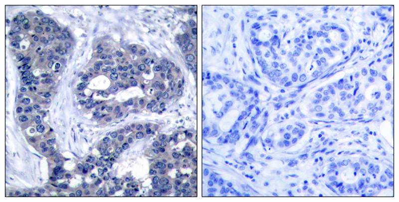 IRS-1(Phospho-Ser639) Antibody