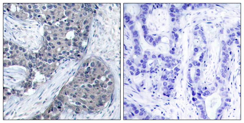 eIF4E(Phospho-Ser209) Antibody