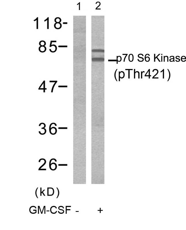 p70 S6 Kinase(Phospho-Thr421) Antibody