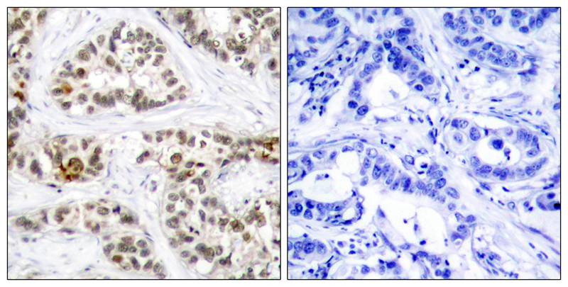 RelB(Phospho-Ser573) Antibody