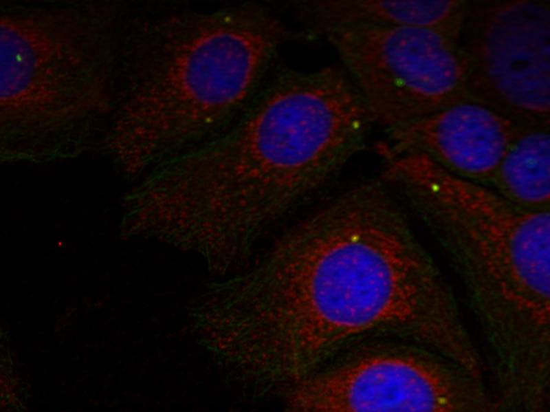 a-Synuclein(Phospho-Tyr125) Antibody