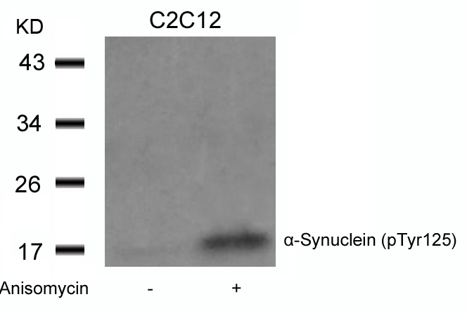 a-Synuclein(Phospho-Tyr125) Antibody