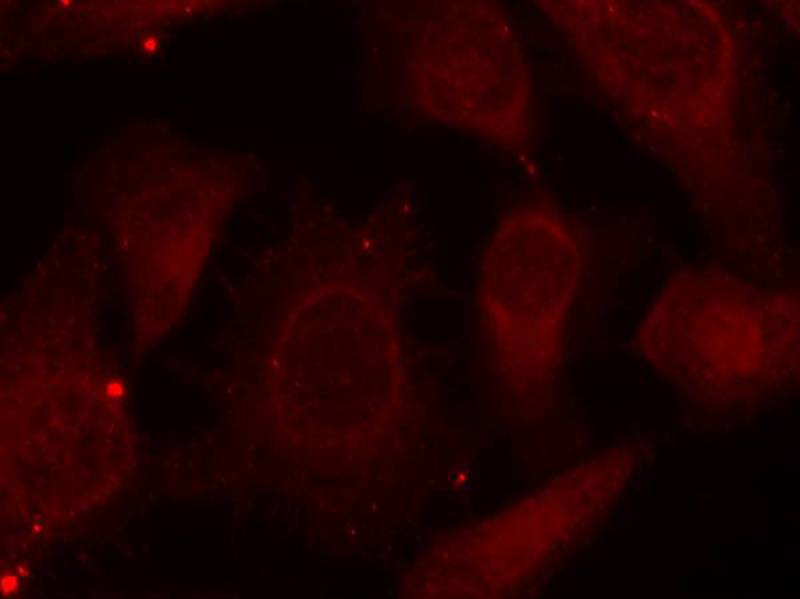 Merlin(Phospho-Ser518) Antibody