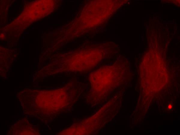 Histone H2A.X(Phospho-Ser139) Antibody