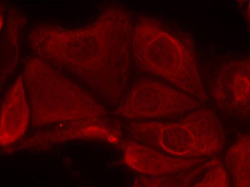 p70 S6 Kinase(Phospho-Ser411) Antibody