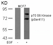 p70 S6 Kinase(Phospho-Ser411) Antibody