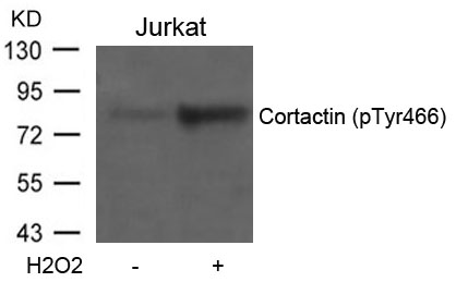 Cortactin(Phospho-Tyr466) Antibody
