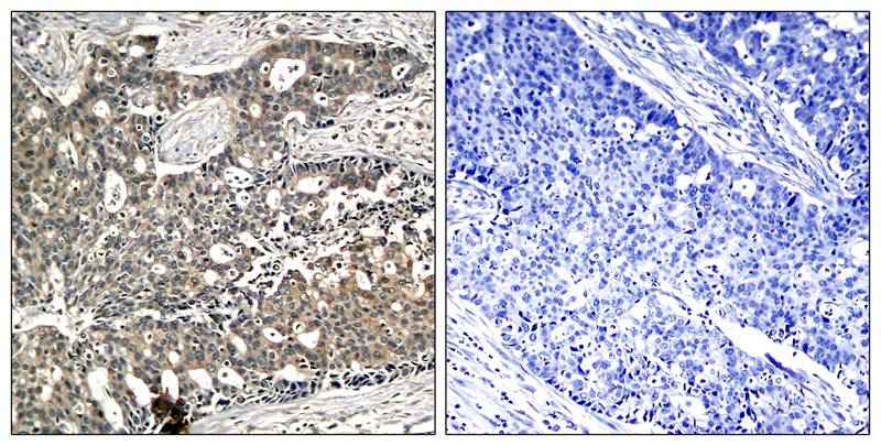 p56Dok-2(Phospho-Tyr299) Antibody