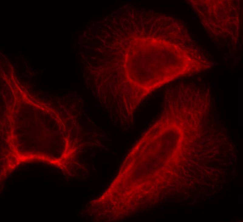 p70 S6 Kinase(Phospho-Ser424) Antibody