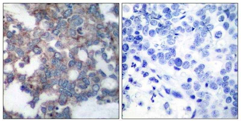 p70 S6 Kinase(Phospho-Ser424) Antibody