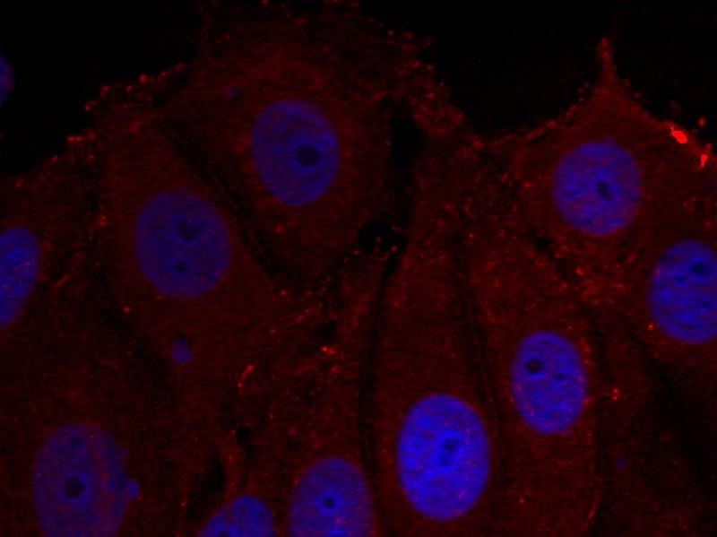 a-Synuclein(Phospho-Tyr133) Antibody