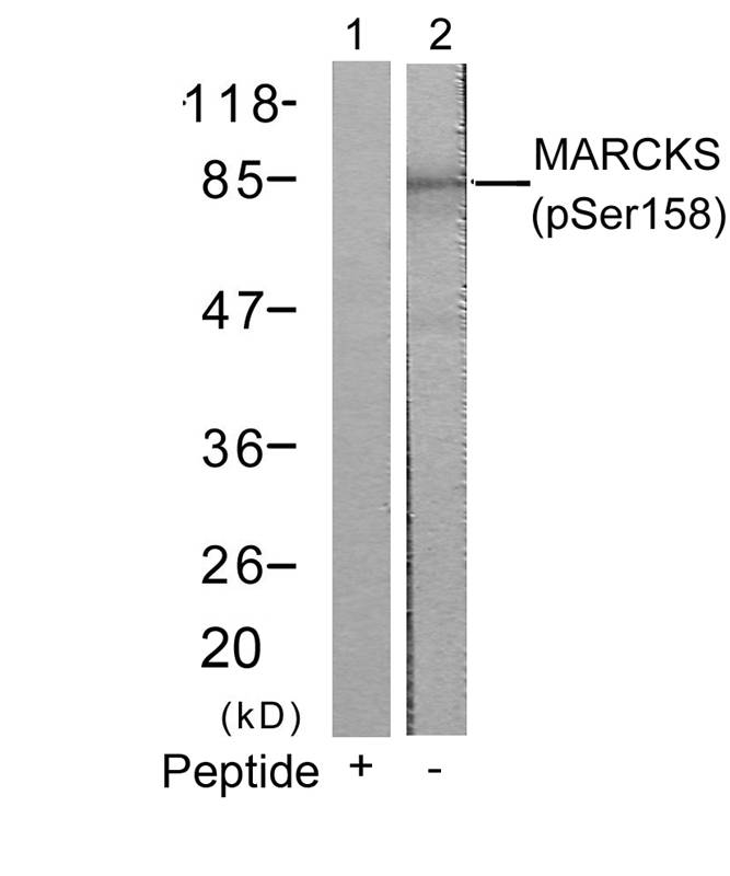 MARCKS(Phospho-Ser158) Antibody
