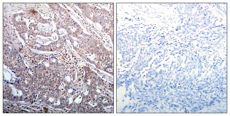 IkB-b(Phospho-Ser23) Antibody