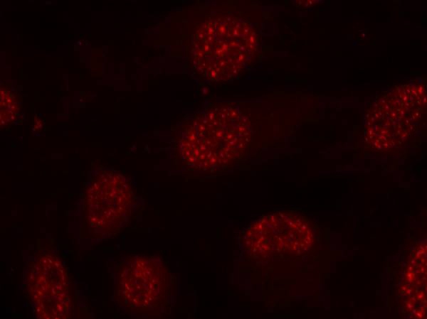 MAPKAPK-2(Phospho-Thr334) Antibody