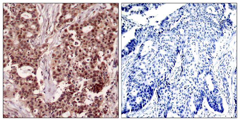 NFkB-p105(Phospho-Ser927) Antibody