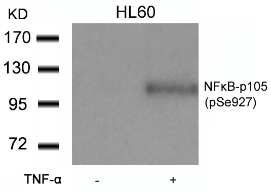 NFkB-p105(Phospho-Ser927) Antibody