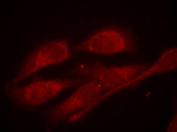 Shc1(Phospho-Tyr427) Antibody