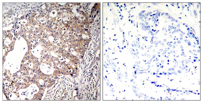 Shc1(Phospho-Tyr427) Antibody