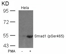 Smad1(Phospho-Ser465) Antibody