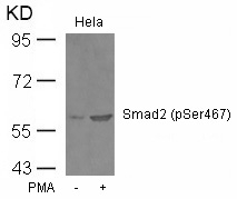 Smad2(Phospho-Ser467) Antibody