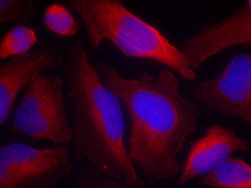 Tyrosine Hydroxylase(Phospho-Ser19) Antibody