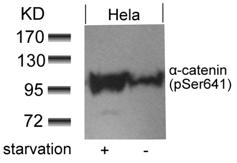 a-catenin(Phospho-Ser641) Antibody