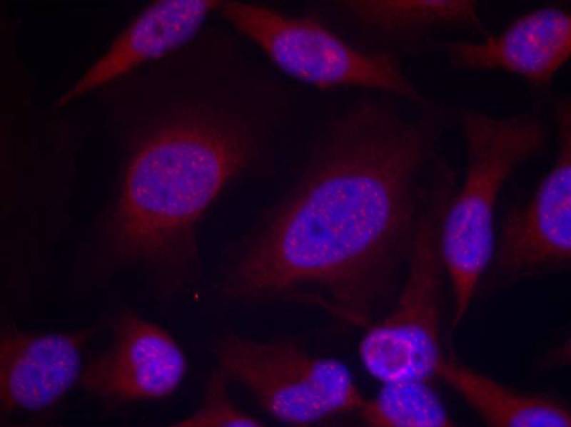 JNK1/JNK2/JNK3(phospho-Thr183/Tyr185) Antibody