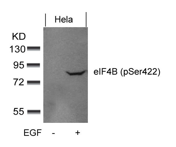eIF4B(phospho-Ser422) Antibody
