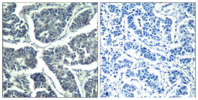 PLCg2(phospho-Tyr1217) Antibody