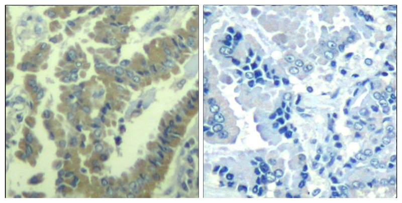 MARCKS(phospho-Ser170) Antibody