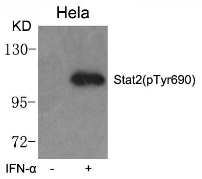 STAT2(phospho-Tyr690) Antibody