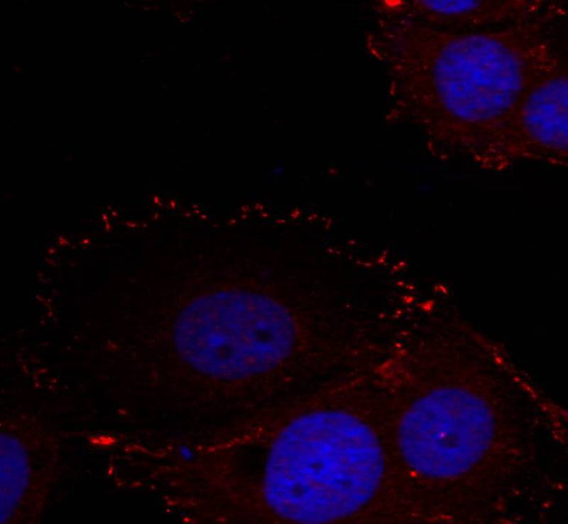 FAK(phospho-Tyr576/Tyr577) Antibody